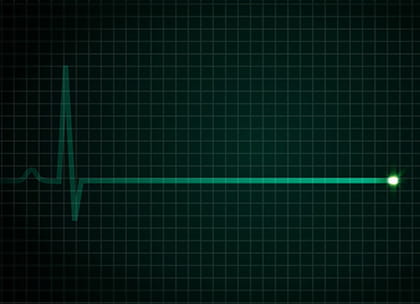 Cardiogram of heartbeat flatlining